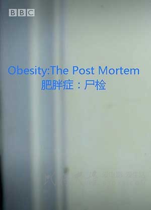 [解剖肥胖][HD-720P-MP4][英语中字][豆瓣8.1分][1012MB][2016]